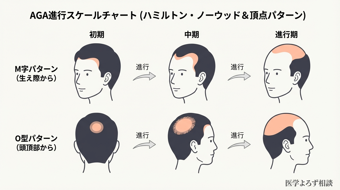 AGA進行スケールチャート：M字パターンとO型パターン