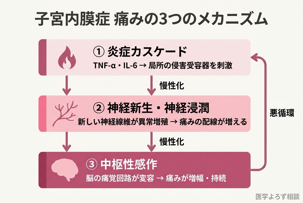 子宮内膜症の3層の痛みメカニズムを示す図。局所炎症、神経新生・浸潤、中枢性感作の3段階が相互に影響する