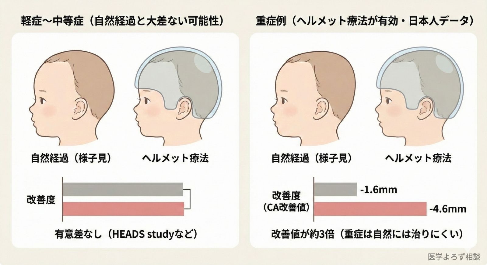 重症度別ヘルメット療法の効果