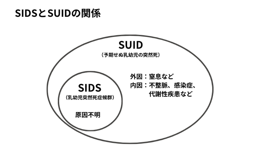 SIDSとSUIDの関係を示すベン図